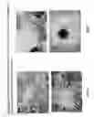 Fig. 10 - Skin equivalents derived from umbilical cord mesenchymal stem/progenitor cells and umbilical cord epithelial stem/progenitor cells