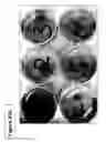 Fig. 100 - Skin equivalents derived from umbilical cord mesenchymal stem/progenitor cells and umbilical cord epithelial stem/progenitor cells