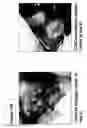 Fig. 101 - Skin equivalents derived from umbilical cord mesenchymal stem/progenitor cells and umbilical cord epithelial stem/progenitor cells