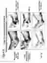 Fig. 108 - Skin equivalents derived from umbilical cord mesenchymal stem/progenitor cells and umbilical cord epithelial stem/progenitor cells