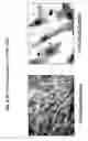 Fig. 14 - Skin equivalents derived from umbilical cord mesenchymal stem/progenitor cells and umbilical cord epithelial stem/progenitor cells