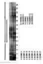 Fig. 21 - Skin equivalents derived from umbilical cord mesenchymal stem/progenitor cells and umbilical cord epithelial stem/progenitor cells