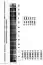 Fig. 22 - Skin equivalents derived from umbilical cord mesenchymal stem/progenitor cells and umbilical cord epithelial stem/progenitor cells