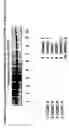 Fig. 24 - Skin equivalents derived from umbilical cord mesenchymal stem/progenitor cells and umbilical cord epithelial stem/progenitor cells