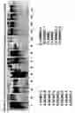 Fig. 31 - Skin equivalents derived from umbilical cord mesenchymal stem/progenitor cells and umbilical cord epithelial stem/progenitor cells