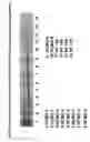 Fig. 35 - Skin equivalents derived from umbilical cord mesenchymal stem/progenitor cells and umbilical cord epithelial stem/progenitor cells