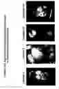 Fig. 46 - Skin equivalents derived from umbilical cord mesenchymal stem/progenitor cells and umbilical cord epithelial stem/progenitor cells