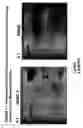 Fig. 48 - Skin equivalents derived from umbilical cord mesenchymal stem/progenitor cells and umbilical cord epithelial stem/progenitor cells