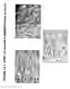 Fig. 59 - Skin equivalents derived from umbilical cord mesenchymal stem/progenitor cells and umbilical cord epithelial stem/progenitor cells
