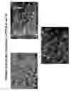 Fig. 63 - Skin equivalents derived from umbilical cord mesenchymal stem/progenitor cells and umbilical cord epithelial stem/progenitor cells