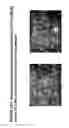 Fig. 65 - Skin equivalents derived from umbilical cord mesenchymal stem/progenitor cells and umbilical cord epithelial stem/progenitor cells