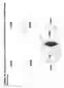 Fig. 66 - Skin equivalents derived from umbilical cord mesenchymal stem/progenitor cells and umbilical cord epithelial stem/progenitor cells