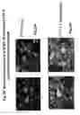 Fig. 85 - Skin equivalents derived from umbilical cord mesenchymal stem/progenitor cells and umbilical cord epithelial stem/progenitor cells