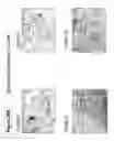 Fig. 89 - Skin equivalents derived from umbilical cord mesenchymal stem/progenitor cells and umbilical cord epithelial stem/progenitor cells