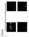 Fig. 99 - Skin equivalents derived from umbilical cord mesenchymal stem/progenitor cells and umbilical cord epithelial stem/progenitor cells