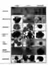 Fig. 01 - Process For Ex Vivo Formation of Mammalian Bone And Uses Thereof
