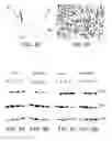 Fig. 05 - REGULATION OF ACHERON EXPRESSION