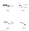 Fig. 08 - Heparanases and splice variants thereof, polynucleotides encoding them and uses thereof