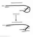 Fig. 01 - Use of Hyaluronidase in Combination with Plasmin for the Induction of Posterior Vitreous Detachment