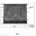 Fig. 02 - Therapeutic Strategy for Treating Autoimmune and Degenerative Diseases