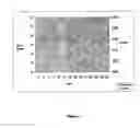 Fig. 03 - Therapeutic Strategy for Treating Autoimmune and Degenerative Diseases