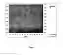 Fig. 04 - Therapeutic Strategy for Treating Autoimmune and Degenerative Diseases