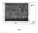 Fig. 05 - Therapeutic Strategy for Treating Autoimmune and Degenerative Diseases