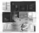 Fig. 01 - Antibodies that bind specifically to phosphorylated β-catenin