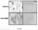 Fig. 10 - Methods for inhibiting the binding of endosialin to ligands