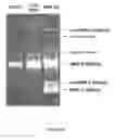 Fig. 15 - Methods for inhibiting the binding of endosialin to ligands