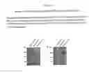 Fig. 02 - Nucleic Acid Molecules Encoding Novel Human Low-Voltage Activated Calcium Channel Proteins, Designed-Alpha 1I-1 and Alpha 1I-2, Encoded Proteins and Methods of Use Thereof
