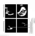Fig. 36 - Modified free-living microbes, vaccine compositions and methods of use thereof
