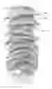 Fig. 01 - Transparent multi-phase dentifrice with patterns
