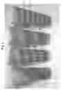 Fig. 03 - Opaque multi-phase dentifrice with coils