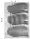 Fig. 04 - Opaque multi-phase dentifrice with coils