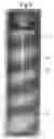 Fig. 06 - Opaque multi-phase dentifrice with coils