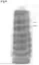 Fig. 07 - Opaque multi-phase dentifrice with coils