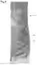 Fig. 10 - Opaque multi-phase dentifrice with coils