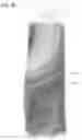 Fig. 11 - Opaque multi-phase dentifrice with coils