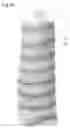 Fig. 14 - Opaque multi-phase dentifrice with coils