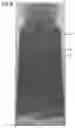 Fig. 16 - Opaque multi-phase dentifrice with coils