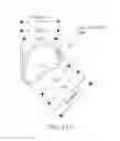 Fig. 40 - SYSTEMS AND METHODS OF PROMOTING ENDOTHELIALIZATION OF A HYBRID HEMODIALYSIS ACCESS GRAFT OR A HYBRID FEMORAL ARTERY BYPASS GRAFT IN A MAMMAL