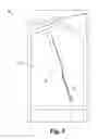 Fig. 05 - Tissue augmentation devices and methods