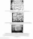 Fig. 05 - Polysaccharide microparticles containing biological agents: their preparation and applications