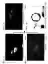 Fig. 03 - Production method of drug containing composite particle