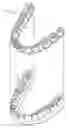 Fig. 01 - ORTHODONTIC APPLIANCES AND MATERIALS FOR MAKING SAME