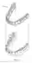 Fig. 02 - ORTHODONTIC APPLIANCES AND MATERIALS FOR MAKING SAME