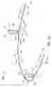 Fig. 03 - Orthodontic apparatus and method