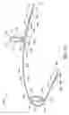 Fig. 05 - Orthodontic apparatus and method