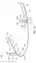 Fig. 06 - Orthodontic apparatus and method